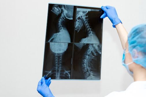 spine disease of osteochondrosis
